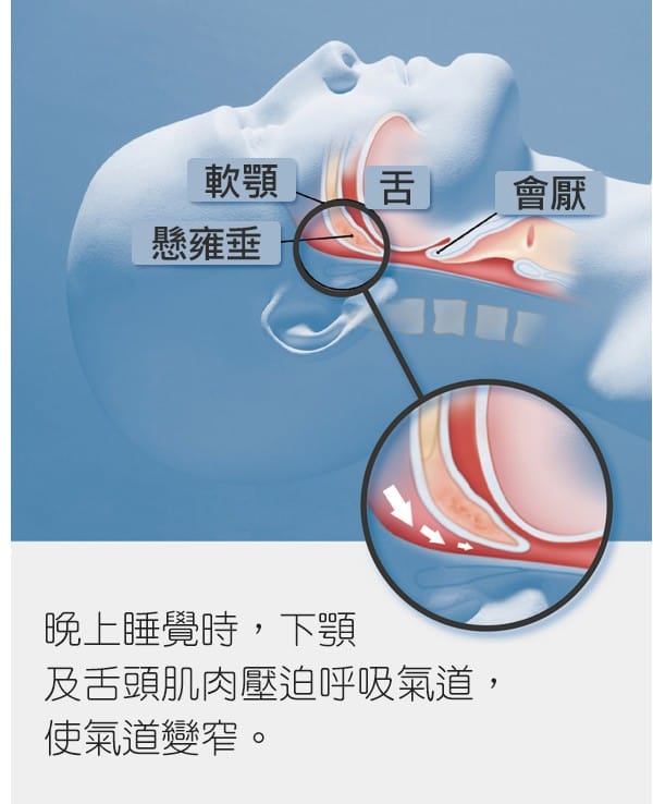 睡眠打鼾原因說明